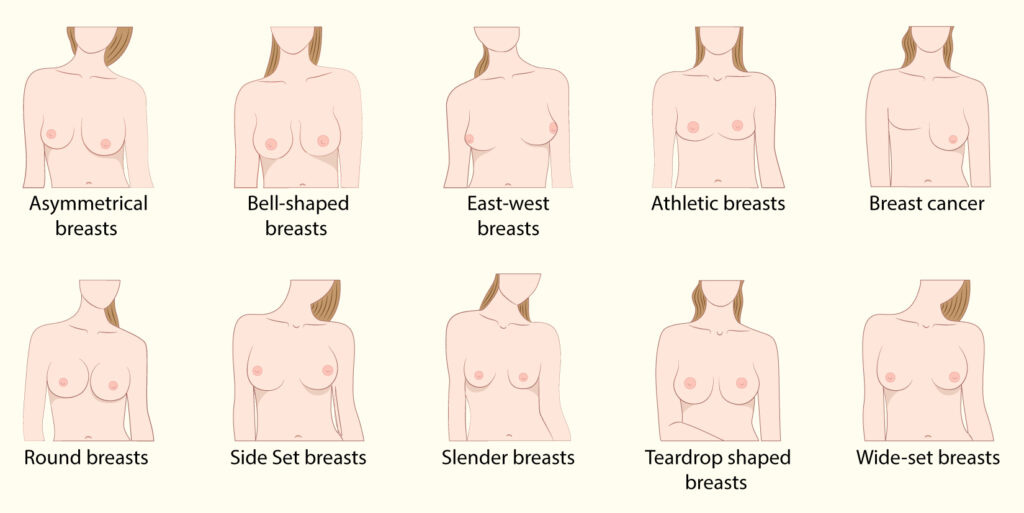 types of breasts 