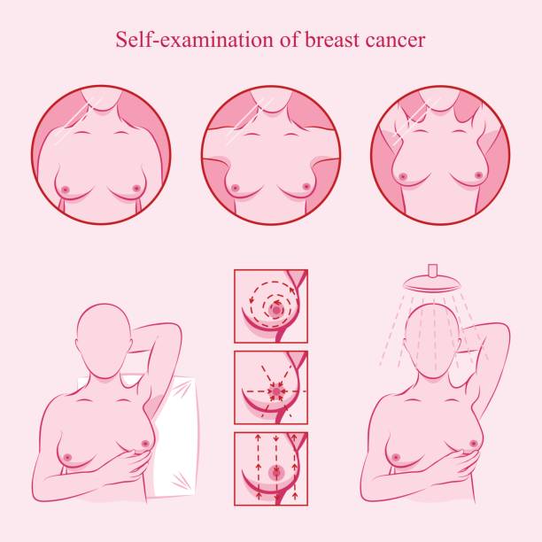 breast checkup