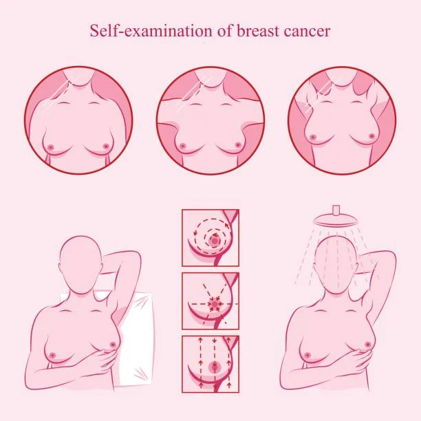 breast checkup