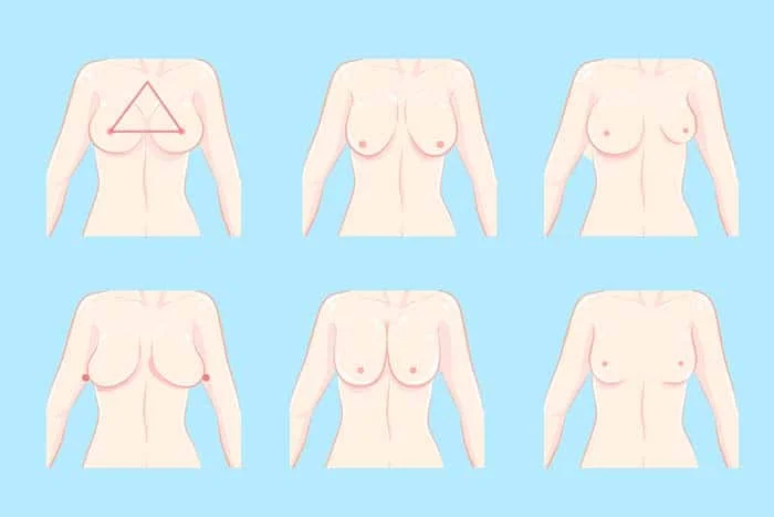 Can breast size differences be corrected naturally?