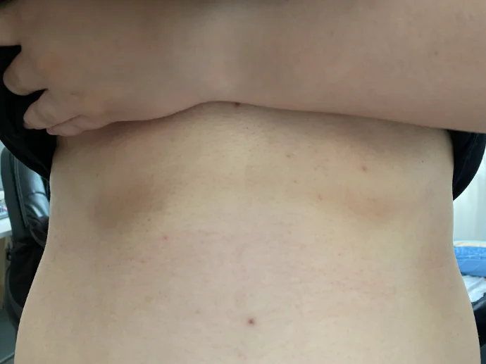 bra marks