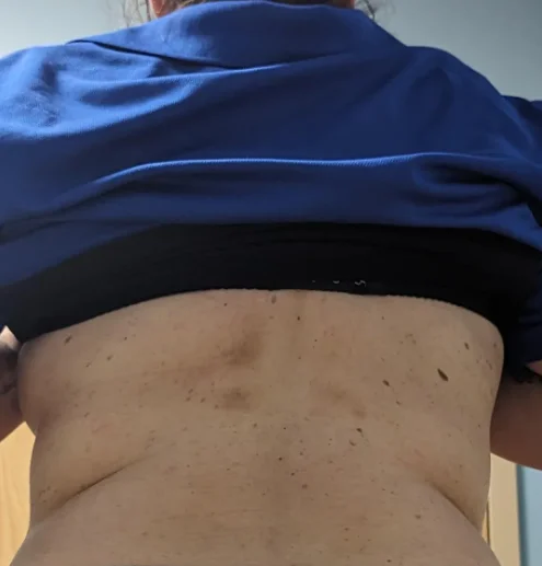 bra lines