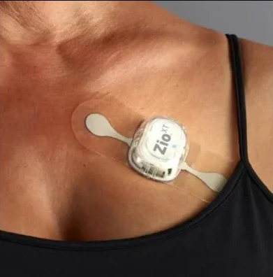 Holter Monitor