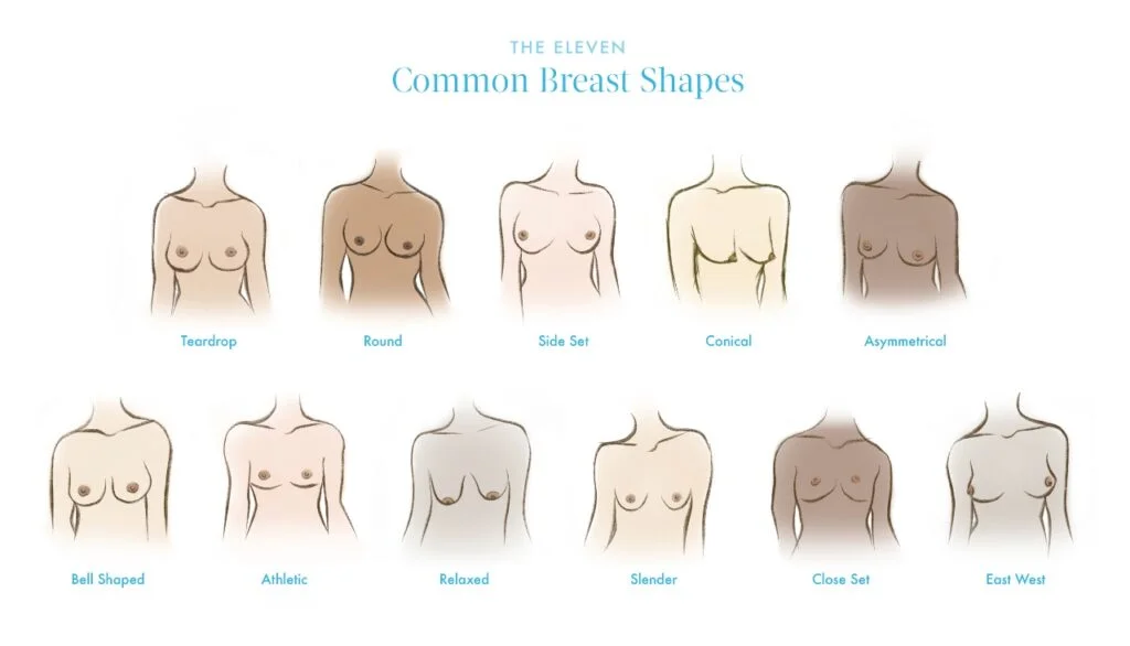 Tps Types Of Breasts Main 1 4X586