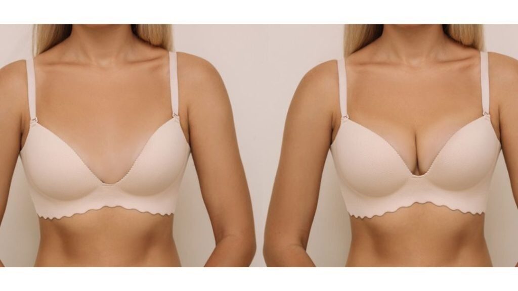 Push-Up Bra After Implants